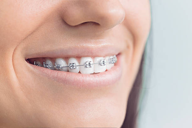 Best Traditional Braces  in Stamford, TX